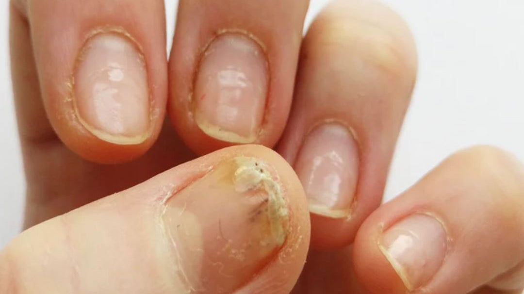 What to Expect from Your Brand if Your Client Suffers an Allergic Reaction